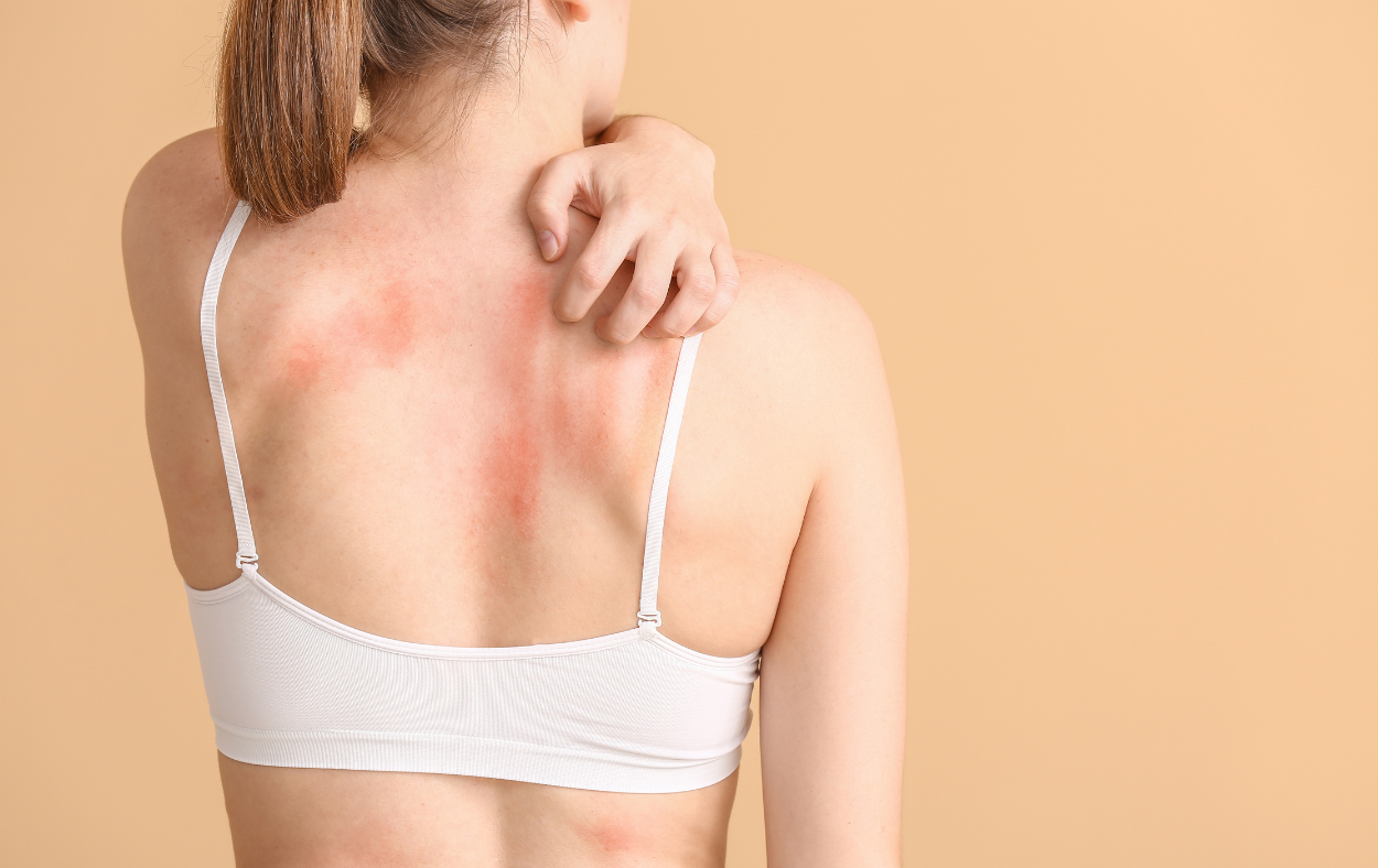Emotional Freedom Technique for common skin problems