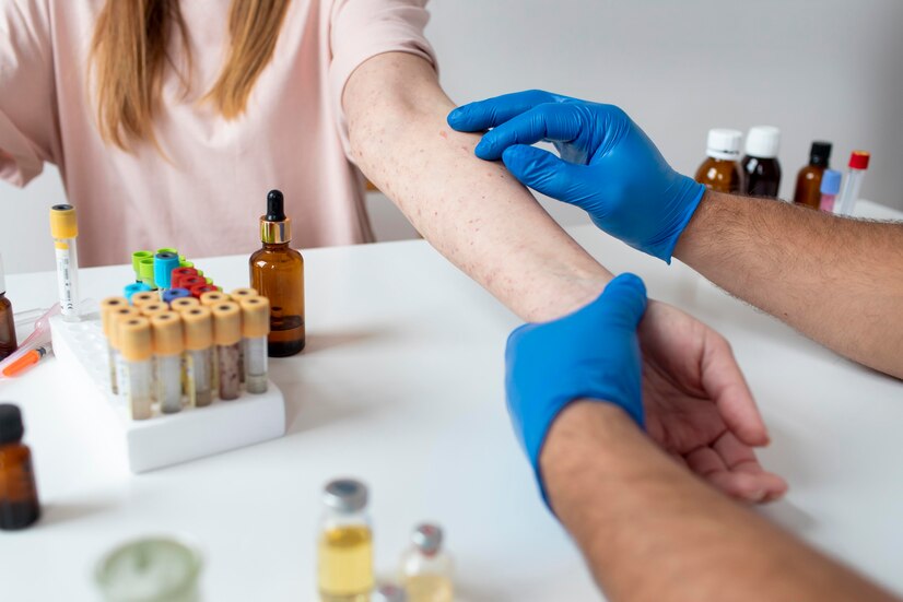 Test to detect allergies; EFT Tapping for skin allergies